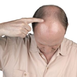 Sorry that I'm Bald!